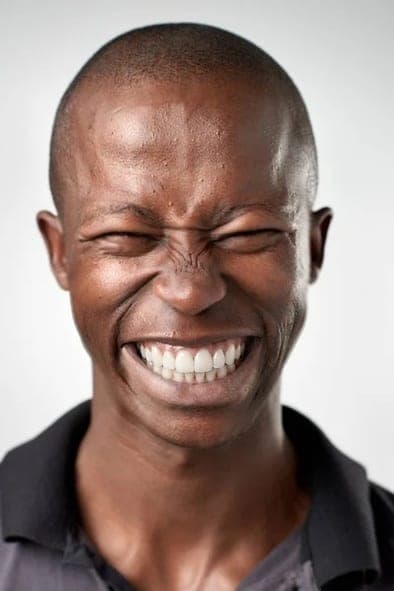 AI Smile Simulator: After (AI simulation)