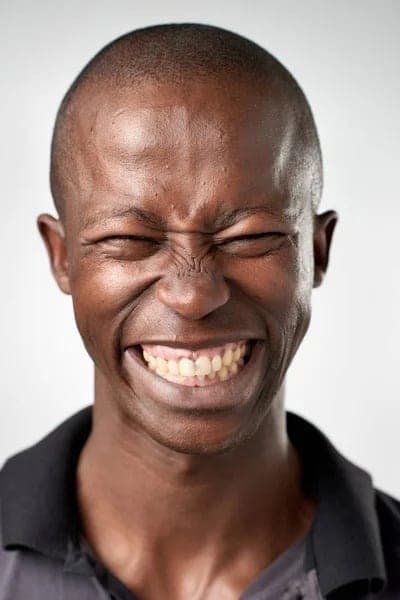 AI Smile Simulator: Before
